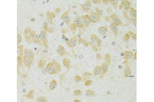 Immunohistochemistry of paraffin-embedded Rat brain using SLC37A4 Polyclonal Antibody at dilution of 1:100 (40x lens).