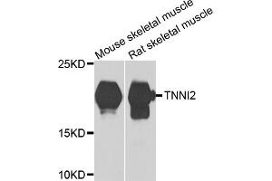 Western blot analysis of extracts of various cell lines, using TNNI2 antibody (ABIN5975229) at 1/1000 dilution. (TNNI2 Antikörper)
