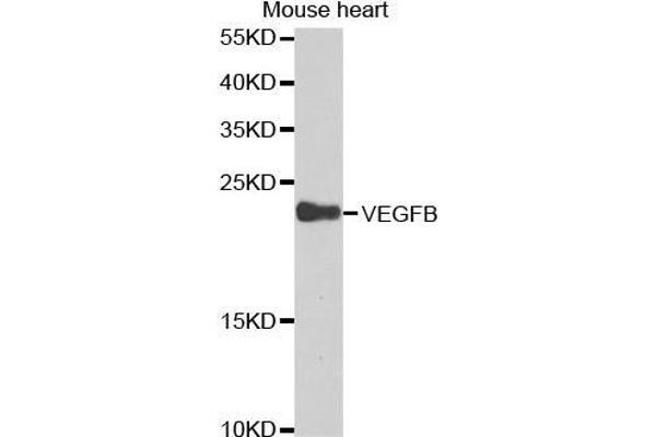 VEGFB antibody  (AA 100-200)