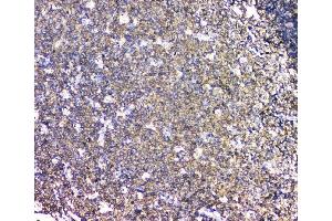 IHC analysis of LCP1 using anti-LCP1 antibody (ABIN6719421). (LCP1 Antikörper)