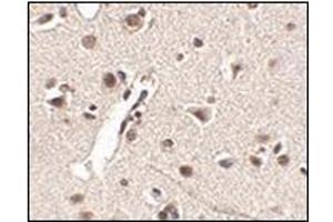 Immunohistochemistry of Rkhd4 in human brain tissue with this product at 2. (MEX3A Antikörper  (C-Term))