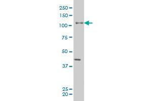 EPHB3 monoclonal antibody (M04), clone 2G8 Western Blot analysis of EPHB3 expression in A-431 . (EPH Receptor B3 Antikörper  (AA 899-997))