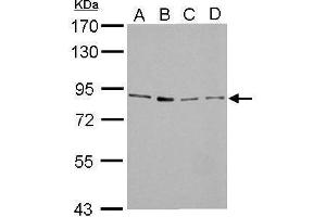 WB Image FOXM1 antibody detects FOXM1 protein by Western blot analysis.