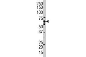 The UBQLN2 polyclonal antibody  is used in Western blot to detect UBQLN2 in HeLa cell lysate. (Ubiquilin 2 Antikörper  (C-Term))
