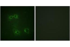 Immunofluorescence analysis of COS7 cells, using FAS (Phospho-Tyr291) Antibody. (FAS Antikörper  (pTyr291))