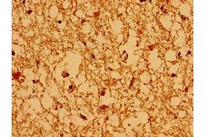 Immunohistochemistry of paraffin-embedded human brain tissue using ABIN7145127 at dilution of 1:100 (AXIN2 Antikörper  (AA 11-77))
