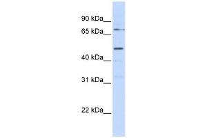 KREMEN1 antibody used at 1 ug/ml to detect target protein. (KREMEN1 Antikörper  (N-Term))
