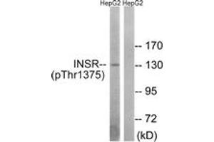 Western blot analysis of extracts from HepG2 cells, using IR (Phospho-Thr1375) Antibody. (IR (AA 1331-1380), (pThr1375) Antikörper)