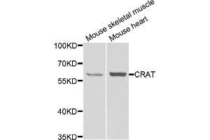 Western blot analysis of extracts of various cell lines, using Crat antibody (ABIN5973772) at 1/1000 dilution. (CRAT Antikörper)