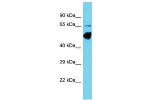Host: Rabbit Target Name: CCDC41 Sample Type: COLO205 Whole Cell lysates Antibody Dilution: 1.