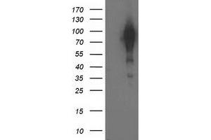 Western Blotting (WB) image for anti-Breast Cancer Anti-Estrogen Resistance 1 (BCAR1) antibody (ABIN1496833) (BCAR1 Antikörper)
