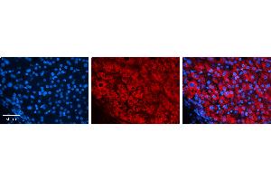 Rabbit Anti-EIF4G2 Antibody   Formalin Fixed Paraffin Embedded Tissue: Human Liver Tissue Observed Staining: Cytoplasm in hepatocytes Primary Antibody Concentration: 1:100 Other Working Concentrations: N/A Secondary Antibody: Donkey anti-Rabbit-Cy3 Secondary Antibody Concentration: 1:200 Magnification: 20X Exposure Time: 0.