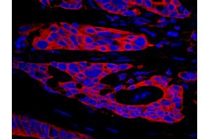 Immunohistochemistry (IHC) image for anti-serine threonine Kinase 39 (STK39) (AA 425-450) antibody (ABIN7448809)
