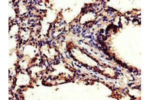 Immunohistochemistry of paraffin-embedded human lung tissue using ABIN7147080 at dilution of 1:100 (CEBPB Antikörper  (AA 41-270))