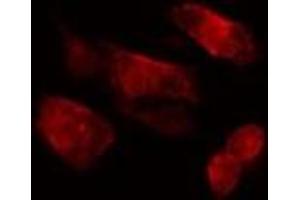 ABIN6275535 staining  HepG2 cells by IF/ICC. (PLK3 Antikörper  (Internal Region))