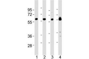 Western blot testing of Lyn antibody at 1:2000 dilution and mouse samples: Lane 1: kidney lysate; 2: heart lysate; 3: ovary lysate; 4: skeletal muscle lysate; Predicted molecular weight 56/58 kDa (isoforms 1/2).