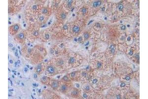 DAB staining on IHC-P; Samples: Human Liver Tissue (Tyrosine Protein Kinase 7 (AA 853-1070) Antikörper)