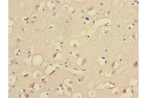 Immunohistochemistry of paraffin-embedded human brain tissue using ABIN7174506 at dilution of 1:100
