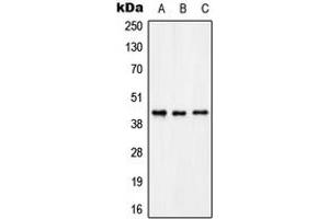 Western Blotting (WB) image for anti-Potassium Voltage-Gated Channel, Shaker-Related Subfamily, beta Member 3 (KCNAB3) (C-Term) antibody (ABIN7297556)