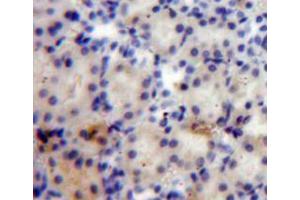 Used in DAB staining on fromalin fixed paraffin-embedded kidney tissue (ANGPTL4 Antikörper  (AA 182-394))