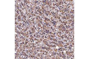 IHC analysis of TOMM34 using anti-TOMM34 antibody (ABIN7599253). (TOMM34 Antikörper  (AA 1-309))