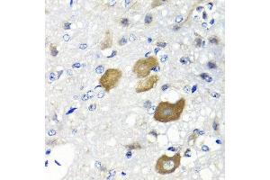 Immunohistochemistry of paraffin-embedded rat brain using IFNL1 antibody at dilution of 1:100 (40x lens). (IL29 Antikörper)