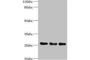 Western blot All lanes: TFAM antibody at 8 μg/mL Lane 1: Jurkat whole cell lysate Lane 2: MCF-7 whole cell lysate Lane 3: A431 whole cell lysate Secondary Goat polyclonal to rabbit IgG at 1/10000 dilution Predicted band size: 30, 26 kDa Observed band size: 26 kDa (TFAM Antikörper  (AA 43-246))