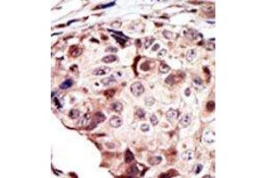 Image no. 1 for anti-RYK Receptor-Like Tyrosine Kinase (RYK) (AA 150-200) antibody (ABIN359937) (RYK Antikörper  (AA 150-200))