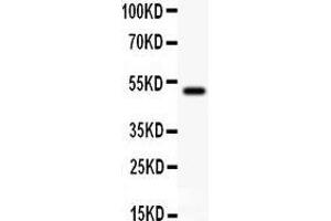 Western Blotting (WB) image for anti-Junction Plakoglobin (JUP) (AA 556-745) antibody (ABIN3043864)