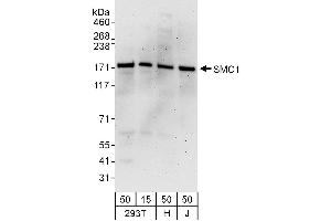 Western Blotting (WB) image for anti-Structural Maintenance of Chromosomes 1A (SMC1A) (AA 1183-1233) antibody (ABIN7454968) (SMC1A Antikörper  (AA 1183-1233))