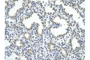 Rabbit Anti-HNRPAB antibody         Paraffin Embedded Tissue:  Human Lung    cell Cellular Data:  alveolar cell    Antibody Concentration:  4. (HNRNPAB Antikörper  (C-Term))