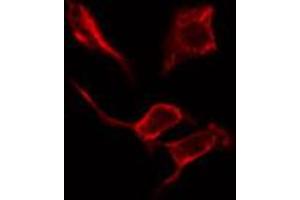 ABIN6274622 staining Hela cells by IF/ICC. (COL4a2 Antikörper  (N-Term))
