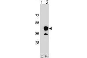 Western blot analysis of CD1b antibody and 293 cell lysate (2 ug/lane) either nontransfected (Lane 1) or transiently transfected (2) with the CD1B gene. (CD1b Antikörper  (AA 57-85))