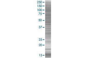 MAP1LC3A transfected lysate.