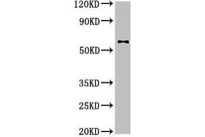 Western Blot Positive WB detected in: U87 whole cell lysate All lanes: DPYSL2 antibody at 4 μg/mL Secondary Goat polyclonal to rabbit IgG at 1/50000 dilution Predicted band size: 63, 59 kDa Observed band size: 63 kDa