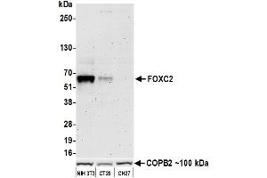Western Blotting (WB) image for anti-Forkhead Box C2 (MFH-1, Mesenchyme Forkhead 1) (FOXC2) (AA 215-265) antibody (ABIN7453342)