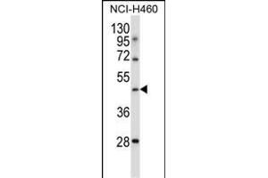 TLE6 Antibody (N-term ) (ABIN657408 and ABIN2846448) western blot analysis in NCI- cell line lysates (35 μg/lane). (TLE6 Antikörper  (N-Term))
