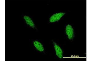 Immunofluorescence of monoclonal antibody to TBR1 on HeLa cell. (TBR1 Antikörper  (AA 1-108))