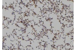 ABIN6269100 at 1/100 staining Mouse lung tissue by IHC-P. (FYN Antikörper  (C-Term))