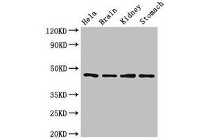 Western Blot Positive WB detected in: Hela whole cell lysate, Mouse brain tissue, Mouse kidney tissue, Mouse stomach tissue All lanes: NOB1 antibody at 1.