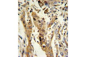 Immunohistochemistry (IHC) image for anti-Glutathione S-Transferase mu 1 (GSTM1) antibody (ABIN3002864)