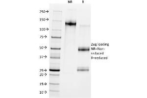 SDS-PAGE Analysis Purified MDM2 Mouse Monoclonal Antibody (SMP14). (MDM2 Antikörper  (AA 154-167))