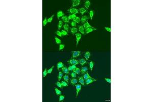 Immunofluorescence analysis of U2OS cells using RASGRP3 antibody. (RASGRP3 Antikörper  (AA 540-689))
