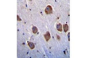 Immunohistochemistry analysis in human brain tissue (formalin-fixed, paraffin-embedded) using NT5DC4  Antibody , followed by peroxidase conjugation of the secondary antibody and DAB staining. (NT5DC4 Antikörper  (Middle Region))
