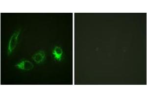 Immunofluorescence analysis of HeLa cells, using IRS-1 (Phospho-Ser323) Antibody. (IRS1 Antikörper  (pSer323))