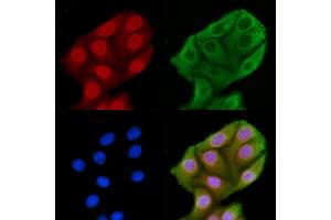 ABIN6262710 and ABIN6269260 staining HepG2 cells by IF/ICC. (JNK Antikörper)