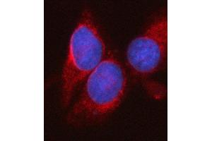 IF analysis of SYT16 using anti-SYT16 antibody (ABIN7599425).