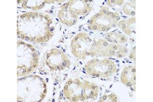 Immunohistochemistry of paraffin-embedded Human stomach using CGB7 Polyclonal Antibody at dilution of 1:100 (40x lens). (CGB7 Antikörper)