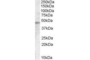 Western Blotting (WB) image for anti-Cytohesin 1 Interacting Protein (CYTIP) (C-Term) antibody (ABIN2156667) (CYTIP Antikörper  (C-Term))