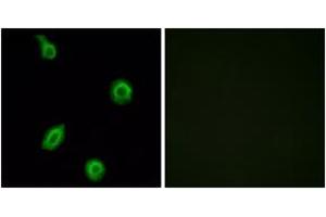 Immunofluorescence analysis of HuvEc cells, using HTR5B Antibody.